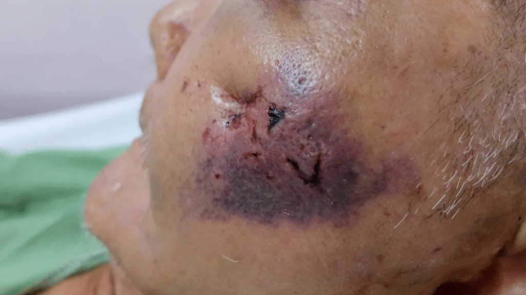 Elective Plastic Surgery: A Difficult Case to Win 1 image 2